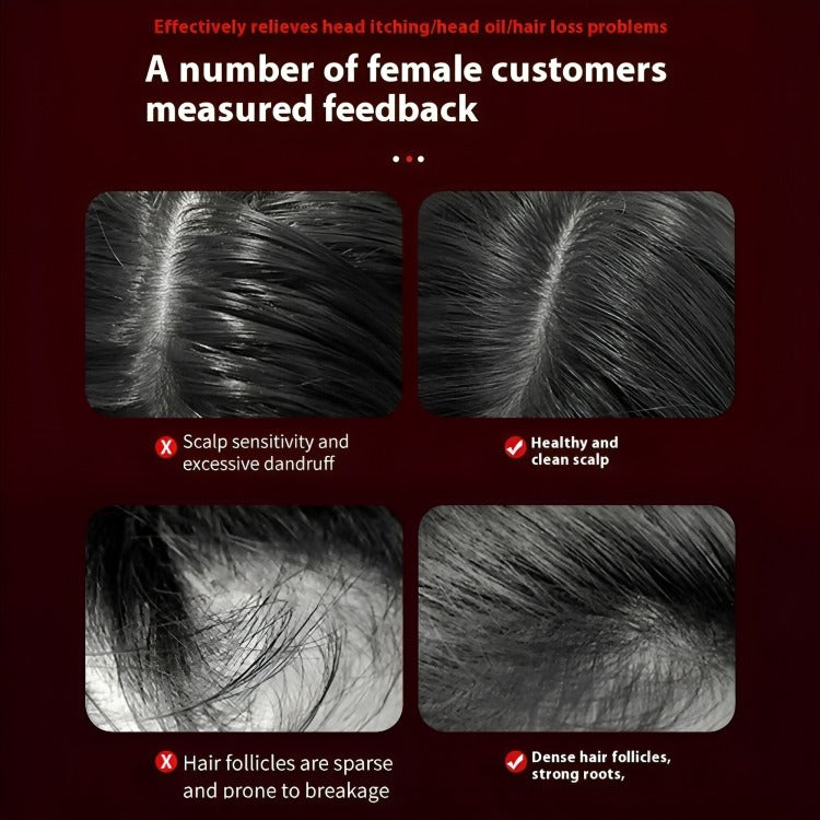 female customer feedback after using Hair Regrowth Massage Comb – Red Light + Oil Applicator + 3 Modes